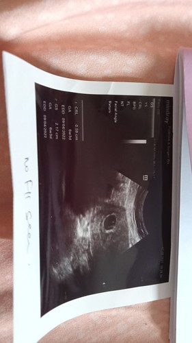 6 week kehamilan perot kembong dan kram