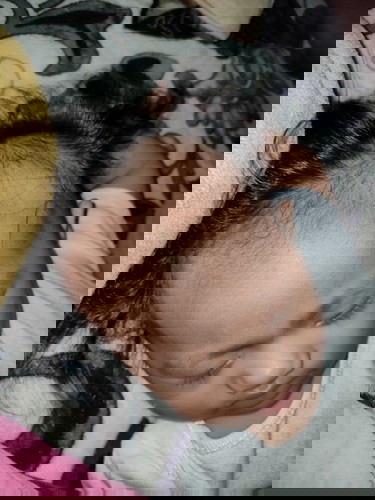 Baby head shape