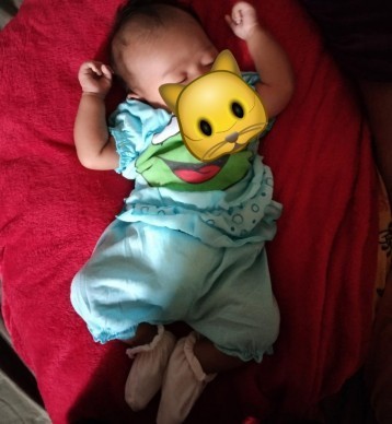 Ada yang tau cara atasi bayi kembung?