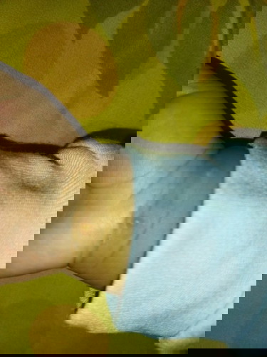 Melenting air pada anak usia 3 bulan