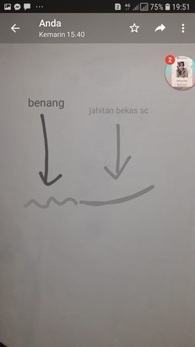 Apakah ini Benang Sc yang tertinggal??