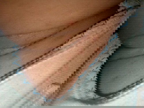 Bintik-bintik kemerahan