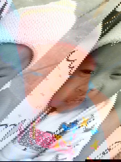 Bintik putih di wajah