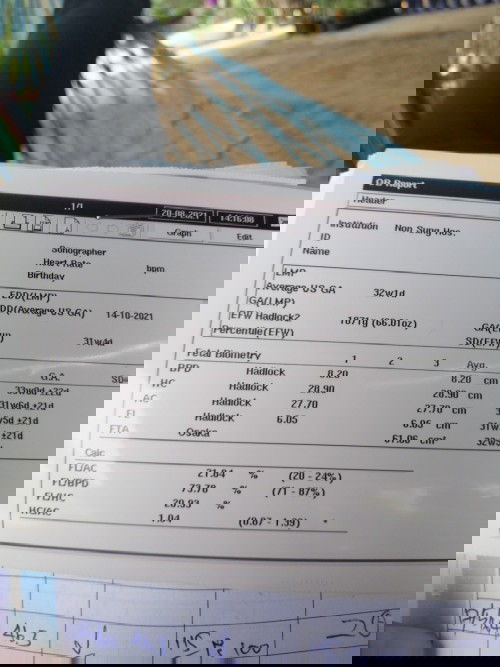 33วีค+4​ น้องบ้านนี้หนัก1871กิโล แม่บ้านอื่นหนักกี่กิโลค่ะ