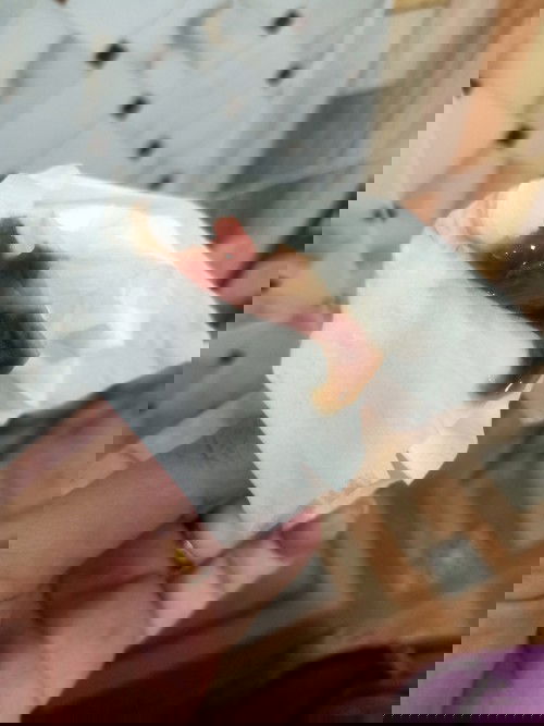 มูกแบบนี้ควรไปโรงพยาบาลเลยมั้ยค่ะ