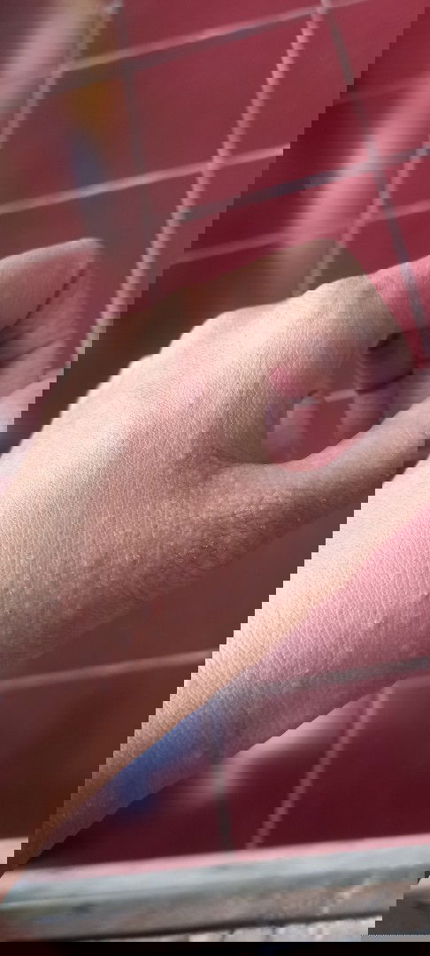 7 bln gejala apa saja yang dialami