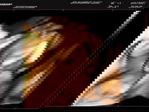 ขอสอบถามหน่อยค่ะ