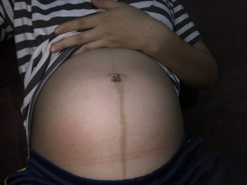 31 สัปดาห์แล้วยังไม่รู้เพศเลยค่ะ อยากรู้ว่าจะได้เพศหญิงหรือเพศชายค่ะ