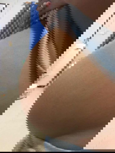 ท้องเริ่มมีรอยแดง เหมือนเตรียมแตกแล้วค่ะ 😲🤣🤣🤣