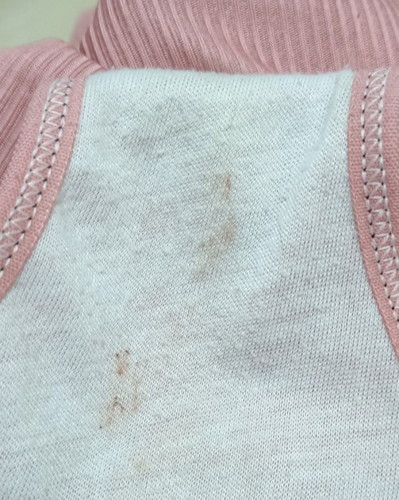 Sy ada sedikit flek pagi ini usia kehamilan saya 15 weeks apa yg hrs sy lakukan, jdwl kntrl mingdep