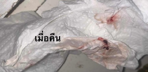 อาการแบบนี้ผิดปกติหรือไม่