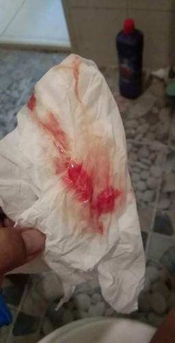 อายุครรภ์ 39 สัปดา ไป รพ. มาแล้ว หมอไล่กลับมาดูอาการ อยากรู้ว่าแบบนี้ใกล้จะคลอด รึยัง