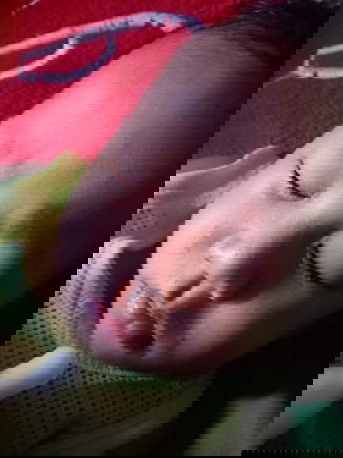 ลูกมีเม็ดๆขึ้นไม่รุ้คืออะไร