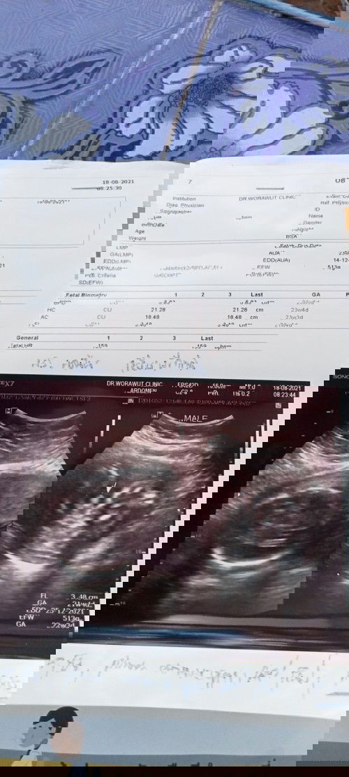 อยากทราบว่ากี่wดูตรงไหนค่ะ