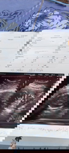 อยากทราบว่ากี่wดูตรงไหนค่ะ