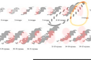 Hamil 11 minggu apakah boleh mengkonsumsi obat polysilane,, karna saya sangat menderita asam lambung