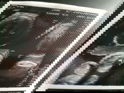 Apa masih bisa normal ketika disuruh SC?