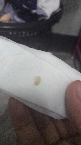 แบบนี้เรียกมูกเลือดรึป่าวค่ะ?