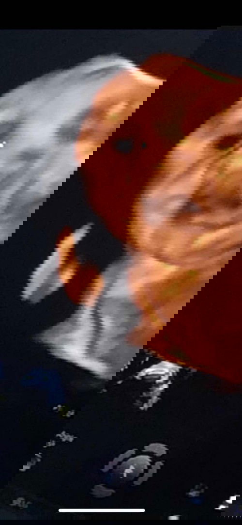 meriang,flu sakit kepala di tm 2