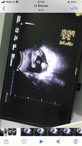 รบกวนช่วยดูให้หน่อยค่ะว่าได้เพศไหน😂