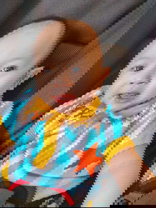 สอบถามเกี่ยวกับท่อน้ำดีอุดตันในเด็กแรกเกิด