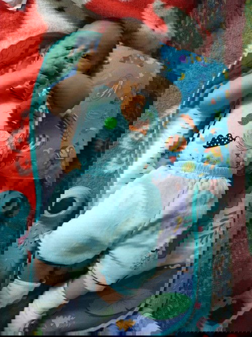 Bayi 3 bulan belum bisa tengkurap dan menegakkan kepala