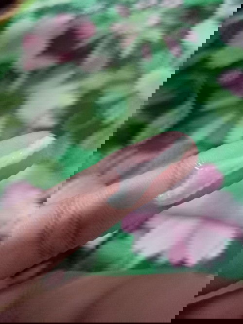 Jelly Like Discharge