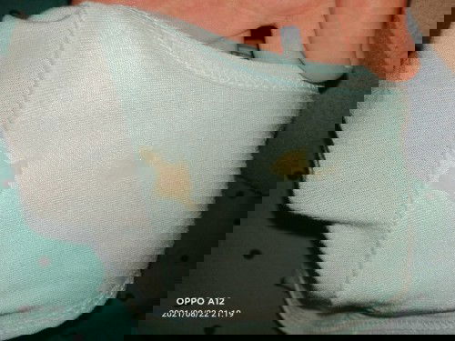 มูกหรือตกขาว