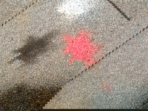 ขออนุญาต​ิสอบถามแม่ๆๆเคยเปนแบบนี้ใมคะตอนนี้แม่กำลังท้องได้18สัปดาห์​5วันแต่นานเปนอาทิตย์​จะเปนแบบนี้