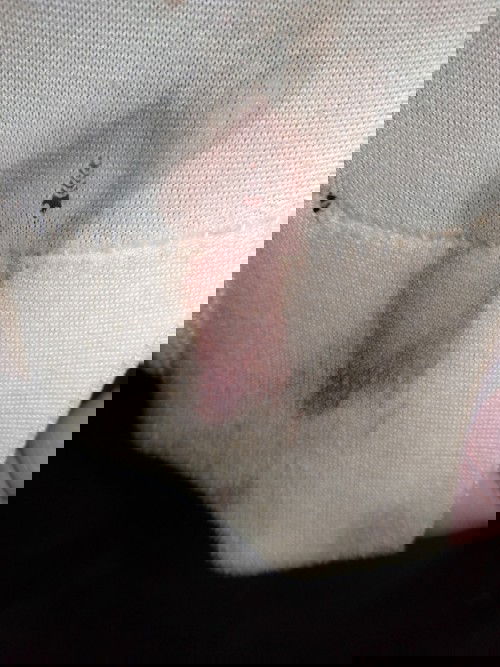 เลือดออกขณะตั้งครรภ์