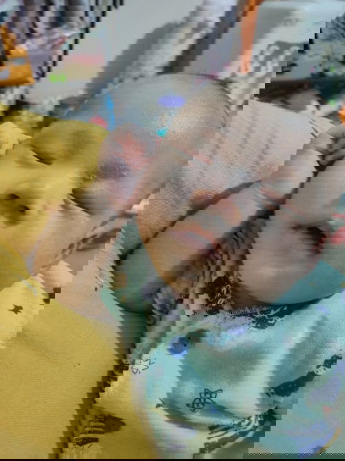 Kerak diatas mata bayi