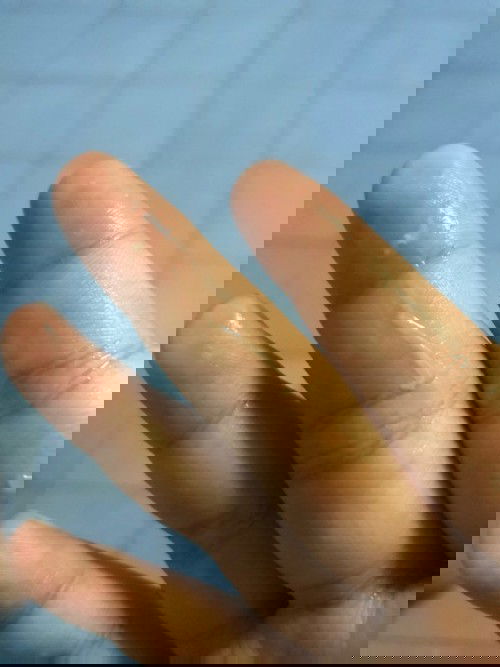 เลยกำหนดคลอดแล้ว