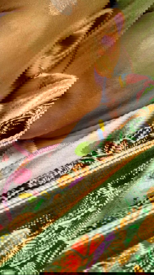 Bercak putih di pipi