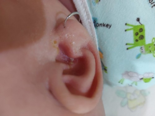 Kuping baby tiba2 bau dan ada putih2nya