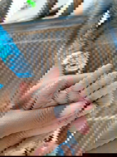 Kulit anak mengelupas