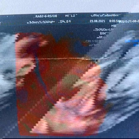 28w3D ทีมเดือนพฤศจิกาจ้าา คุณแม่ไหนอื่นล่ะคะ?😊