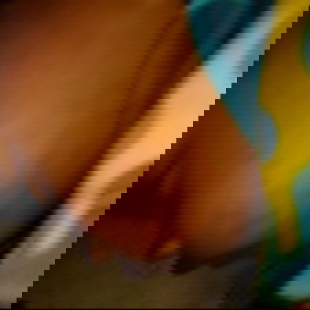 Kenapa kaki tangan dan wajah tiba' merah seperti ini ya?