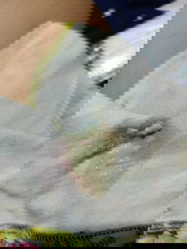 ท้อง37สัปดาห์เป็นตกขาว