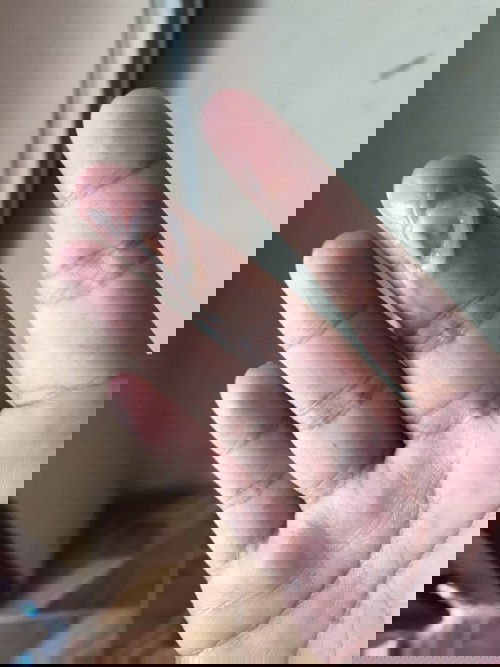 ขอสอบถามหน่อยค่ะ แบบนี้มูกหรือตกขาวคะ