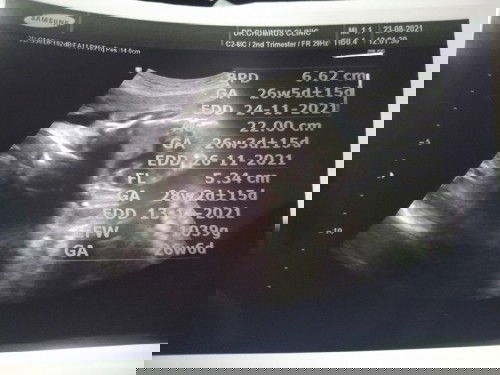 ท้อง26สัปดาห์แล้วค่ะน้ำหนักแม่43โลแต่น้ำหนักลูก1039กรัม