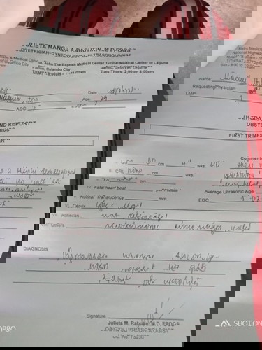 Ano po kaya ibig sabhin nito? Maraming salamat po sa tutugon. Ang sabi lang kasi may posibilidad