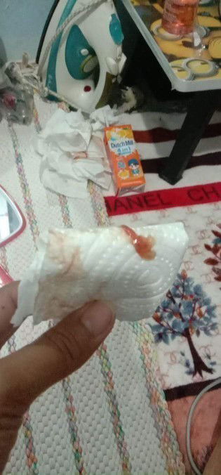 อยากทราบการกระตุ้นปากมดลูก