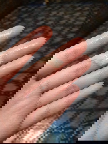 แม่ๆคะแบบนี้ใช่มูกมั้ยคะ ท้องได้36w+3d ทีมกันยา มีเจ็บท้องเตือน2วันแล้ว