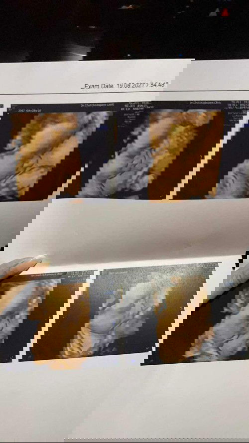 สวัสดีคับผม28wแล้วคับ 🥰