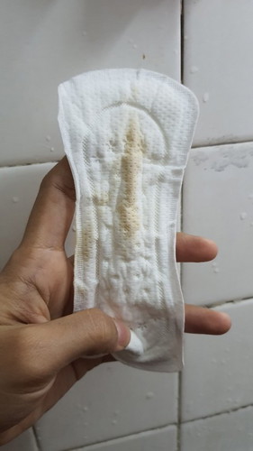 Darah bercampur keputihan