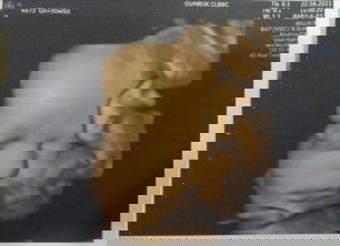 👶🏻ขอคำแนะนำด้วยค่ะ