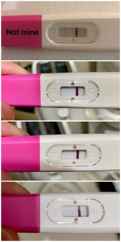 Help! 11 DPO not sure kung shadow lang