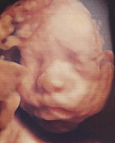 ภาพเพื่อนๆเป็นไงมั่งคับ 28week