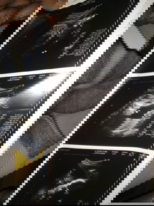 ได้ลูกสาวครับ