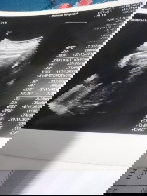 ญรึชช่วยดูหน่อย